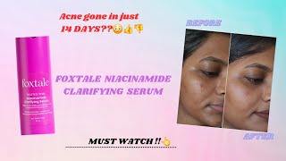 New Foxtale Niacinamide Clarifying Serum review after 14 days‼️😳Watch thatglowaddictskincare✨️ [upl. by Carlynn661]