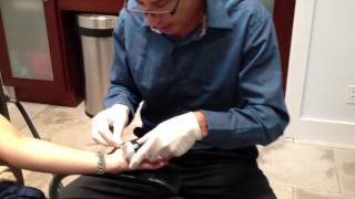 Treating Palmer Hand Hyperhidrosis with Botox near painlessly with cooling Steve Weiner MD [upl. by Dollie]