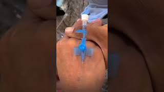 IV cannula insertiondocternursingmotivationviralvideoshortvideoivcannulashortvideolove [upl. by Abehsat]