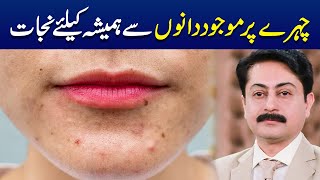 Acne treatment at home Herbal remedies  Dr Faisal Syed [upl. by Fax]