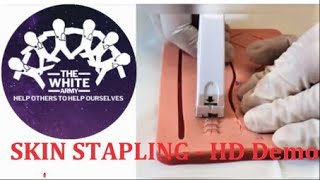 SKIN STAPLING  HD Demonstration [upl. by Rennug843]