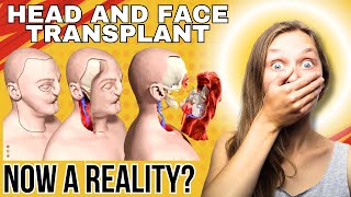 HEAD AND FACE TRANSPLANT Now A Reality transplants headtransplant facetransplant surgery head [upl. by Anavi]