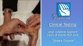 quotSkiers Thumbquot  Clinical Testing [upl. by Nirik459]