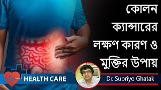 Colon Cancer Symptoms and treatment  warning signs of Colon Cancer  Dr Supriyo Ghatak [upl. by Halimak]