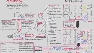 Liver Cirrhosis SandS Pathophysiology Investigations Management [upl. by Bilat]