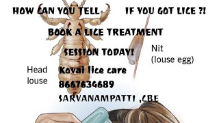 How to remove nits and lice treatment nits lice nits and lice lice treatment eeru peenu hair [upl. by Hcaz780]