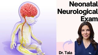 How to perform the NEURO exam on a baby HeadtoToe CNS evaluation [upl. by Hugon]