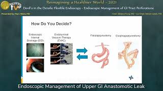 Endoscopic Management of Upper GI Anastomotic Leak [upl. by Dnomal]