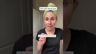 The truth about hormonal acne dermatologist DrDrayzday [upl. by Yttig]