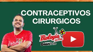 CONTRACEPTIVOS CIRÚRGICOS [upl. by Aititil]