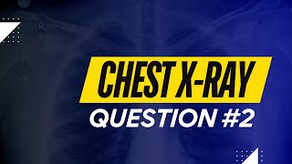 Chest Xray Question 2 with detailed explanation [upl. by Aisel]