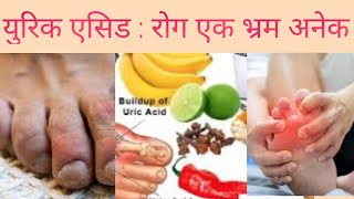 Uric acid and Myths in Nepali Dr Bhupendra shah  doctor sathi [upl. by Odraner]