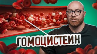 КАК ГОМОЦИСТЕИН МОЖЕТ УГРОБИТЬ ВАШ ОРГАНИЗМ [upl. by Nataniel]