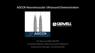 Neuromuscular Ultrasound Demonstration AOCCN 2021 Nens van Alfen MD PhD [upl. by Alicia926]