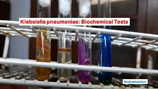 Klebsiella pneumoniae biochemical tests [upl. by Aivatnuhs]