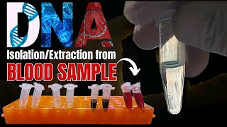 DNA Extraction from Blood Samples Comprehensive StepbyStep Guide  Molecular Biology Laboratory [upl. by Yenahc765]