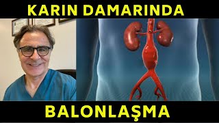 Karın Damarında Balonlaşma Abdominal Aort AnevrizmasıSerdar Akgün [upl. by Cairistiona138]