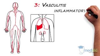 Rheumatology – Polyarticular Pain By Lori Albert MD [upl. by Shandee]