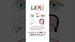 LambertEaton Myasthenic Syndrome LEMSscience anatomy mbbs usmle nclex nurse biology [upl. by Georg]