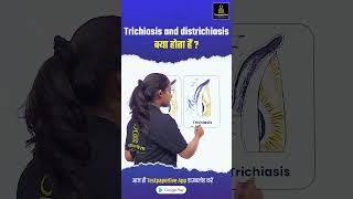 Trichiasis and districhiasis क्या होता हैं Ophthalmic districhiasis Trichiasis DOTClass eye [upl. by Herminia]