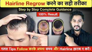 100 Result  Hairline Growth Tips 2023  Receding Hairline से छुटकारा [upl. by Yrallam]