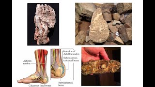 A New Species of Engineered Hominids shows Darwinism and His Origin of Species Likely to be Wrong [upl. by Loesceke]