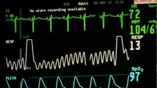 cardiac monitor [upl. by Aggie]