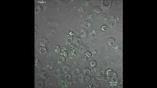 An intracellular replication niche for Vibrio cholerae in the amoeba Acanthamoeba castellanii [upl. by Sayce]