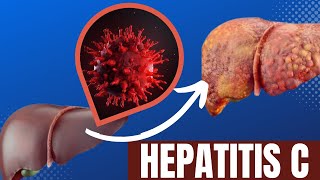 ¿Qué es la Hepatitis C [upl. by Candie]