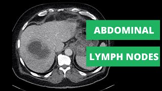 Abdominal CT Lymph Node Stations  How to read a CT [upl. by Moulton426]