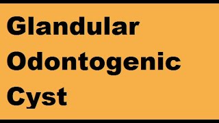 Glandular Odontogenic Cyst [upl. by Dotty866]