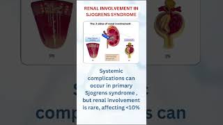 Sjogrens syndrome with Renal tubular acidosis with periodic paralysis [upl. by Lilak]