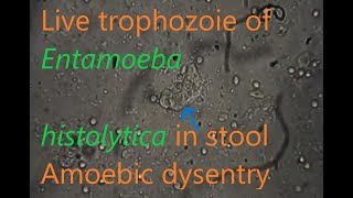 Entamoeba histolytica trophozoite in stool [upl. by Sakul]