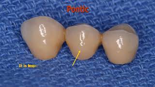 fixed prosthodontics introduction 1th lec 2018 19 [upl. by Ssecnirp769]