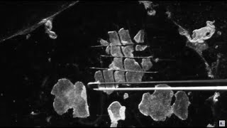 3 Methods for Passaging of Pluripotent Stem Cells [upl. by Niletak]