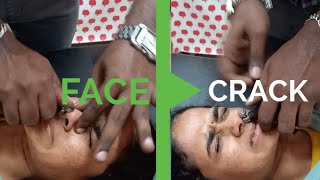 CRANIAL FACIAL RELEASE Technique by DrSuresh KumarCFR technique in India [upl. by Jasisa215]