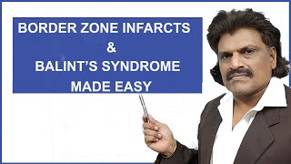 BORDER ZONE INFARCTS amp BALINTS SYNDROME MADE EASY [upl. by Callan]