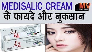 Medisalic cream  full review  hindi  हिन्दी [upl. by Seward]