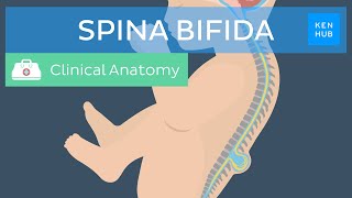 Spina bifida Causes classification prevention and treatment  Kenhub [upl. by Nylekoorb]