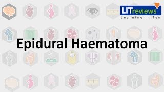 Epidural Haematoma [upl. by Eceinal]