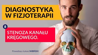 Stenoza kanału kręgowego Diagnostyka w fizjoterapii Odcinek 8 [upl. by Ylra]