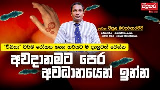 මොකක්ද මේ ටීනියා දිලීර රෝගය  අවදානමට පෙර අවධානයෙන් සිටින්න tinea virus vidusara [upl. by Netsrik648]