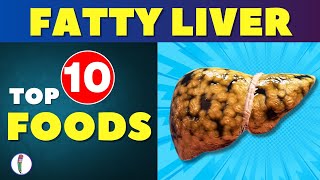 Fatty Liver Diet 🥘🥦 Top 10 Foods to Reverse amp Protect  Fatty Liver Treatment  Liver Detox [upl. by Latihs]