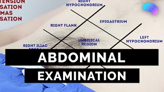 Abdominal Examination  OSCE Guide Latest  UKMLA  CPSA [upl. by Georgine665]