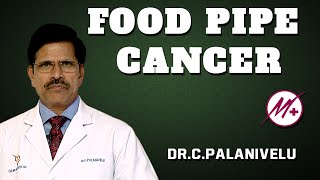 Adenocarcinoma  Food Pipe Cancer  Esophageal Cancer   DrCPalanivelu [upl. by Eniaj631]