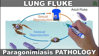 Paragonimiasis  Lung fluke and its Life Cycle [upl. by Craner928]