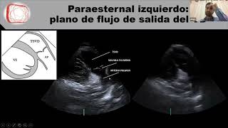 Clase 1 El ecocardiograma normal Dr Freytes [upl. by Jaban]