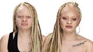 MAKEUP TUTORIAL FOR WOMEN WITH ALBINISM ft fenty beauty profilter foundation [upl. by Kirenoj]