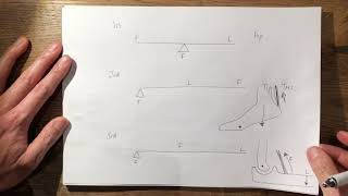 23 Free Body Diagram Principles FRCS TrampOrth [upl. by Dagmar152]