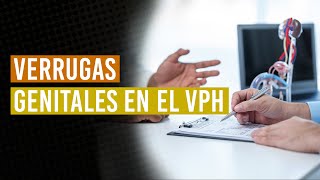 Verrugas genital y Virus del Papiloma Humano  ¿Qué son ¿Cómo tratarlas [upl. by Anaert]